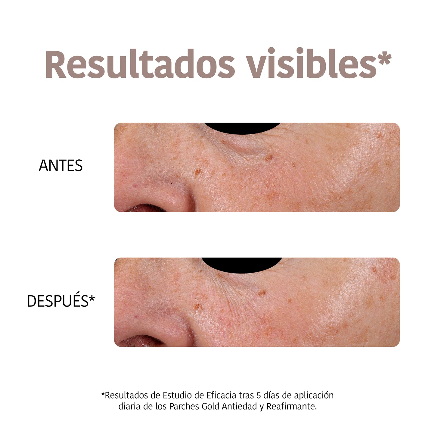 Patchs contour des yeux anti-âge GOLD + Peptides