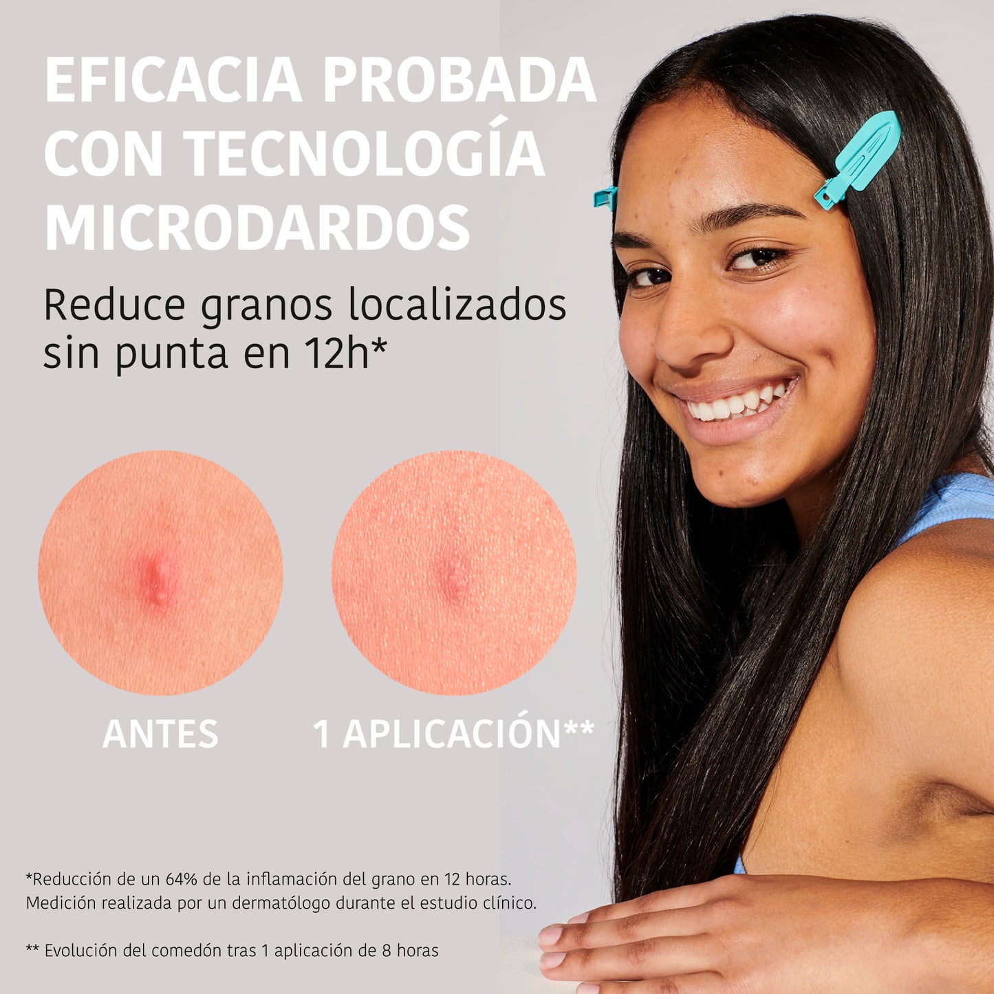 Patchs boutons à micro-dards à l’Acide Salicylique