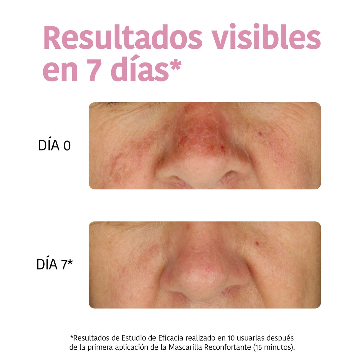 Masque hydratant à l'aloe vera