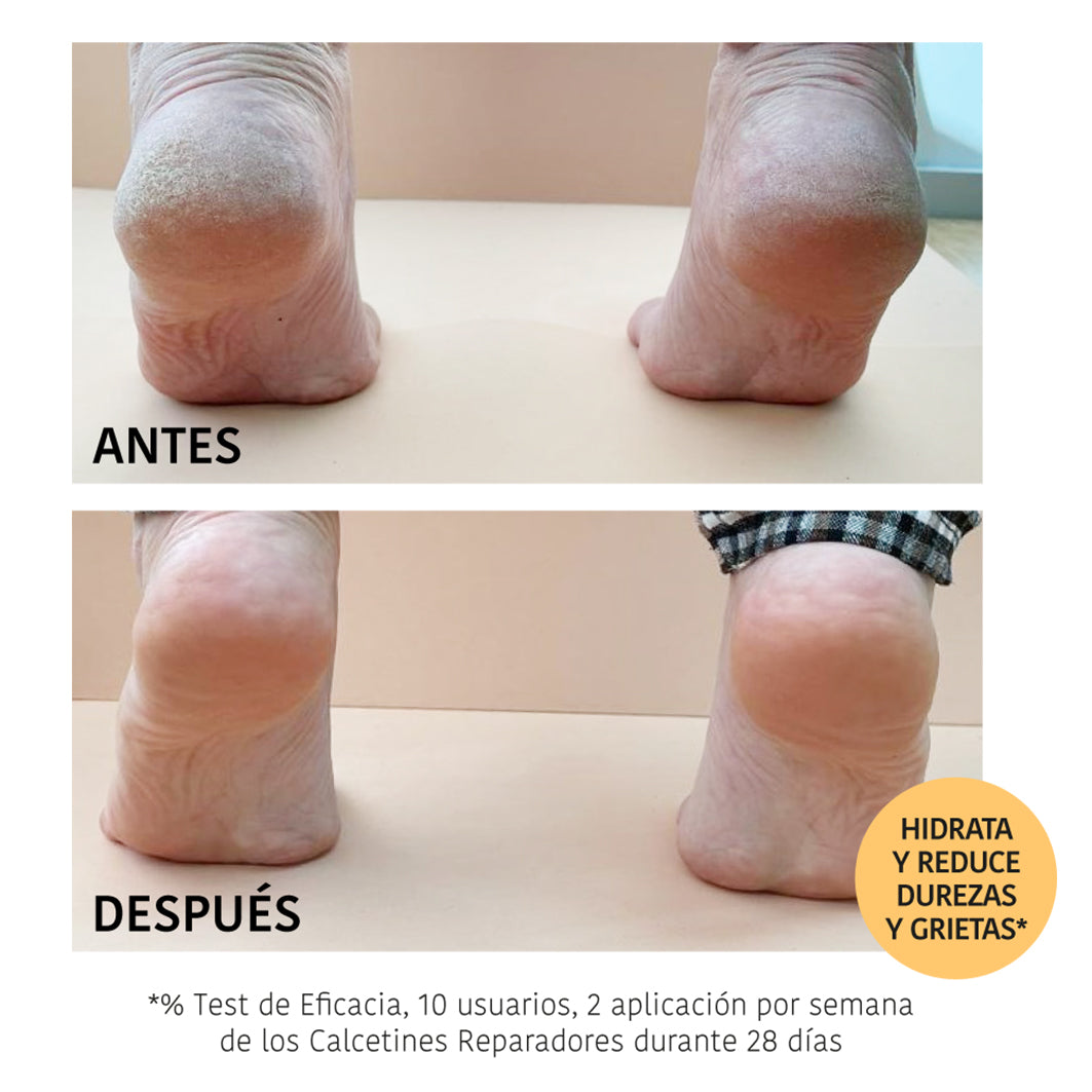 Les Chaussettes Masque Réparatrices Pêche