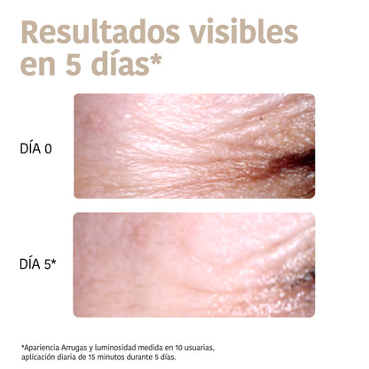 Patchs Yeux Anti-âge à la Niacinamide