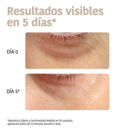 Patchs Yeux Anti-âge à la Niacinamide