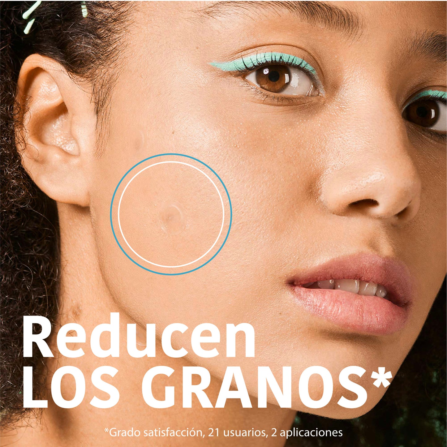 Patchs anti-boutons SOS à l'acide salicylique