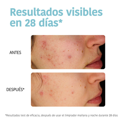 Nettoyant purifiant - Acné