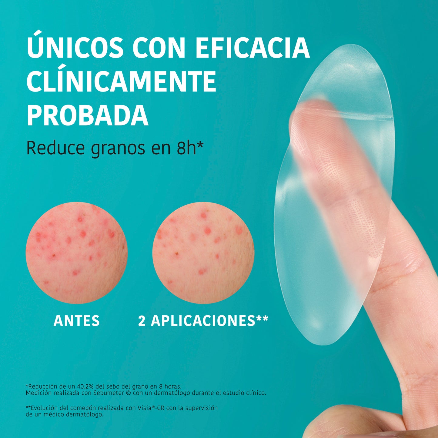 Patchs XL pour les boutons - Acide salicylique