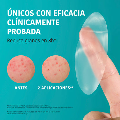 Patchs XL pour les boutons - Acide salicylique