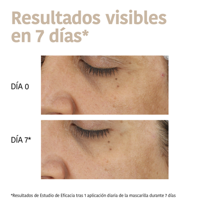 Masque anti-taches à l'acide tranexamique