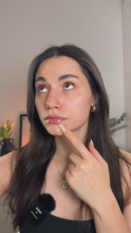 Disques Toniques Exfoliants - Acné