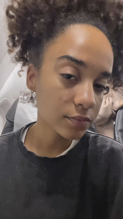 Patchs Yeux Anti-fatigue à la Vitamine C