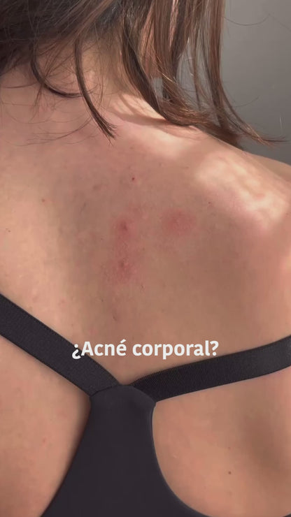 Patchs XL pour les boutons - Acide salicylique